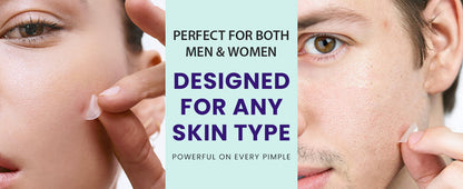 Hydrocolloid Acne Patches 36 Count Pimple Treatment